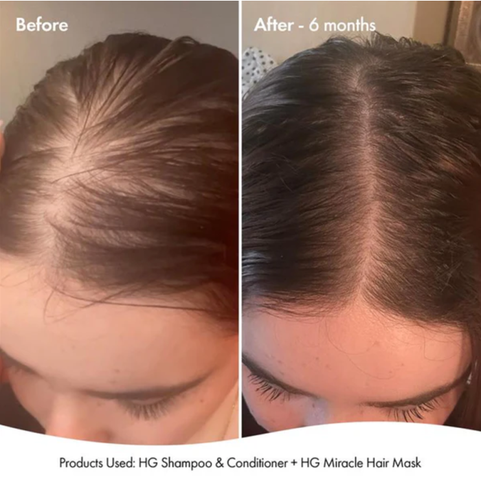 Bondi Boost Miracle Hair Mask For Thinning Hair